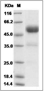 Cynomolgus ALK-1 / ACVRL1 Protein (Fc Tag) SDS-PAGE