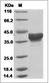 Ebola virus EBOV (subtype Zaire, strain H.sapiens-wt/GIN/2014/Kissidougou-C15) Matrix protein VP40 Protein (His Tag)