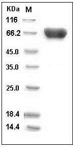 Human TROP2 / TACSTD2 Protein (His & Fc Tag) SDS-PAGE