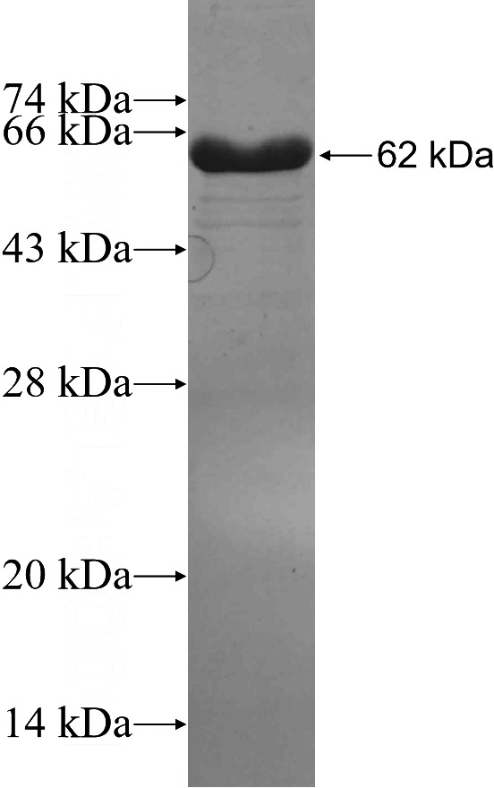 Recombinant Human SYT9 SDS-PAGE