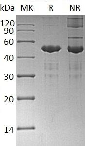 Human UBE2A/RAD6A (GST & His tag) recombinant protein