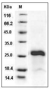 Human IGJ / Immunoglobulin J chain Protein (His Tag) SDS-PAGE