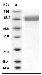 Human TEM7 / PLXDC1 Protein (His Tag) SDS-PAGE
