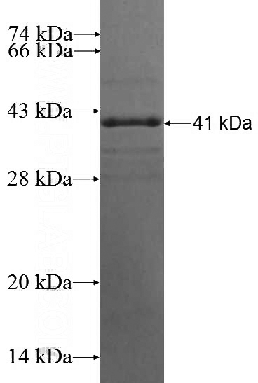 Recombinant Human ECHDC1 SDS-PAGE