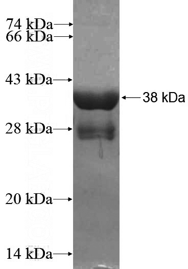 Recombinant Human ABI1 SDS-PAGE