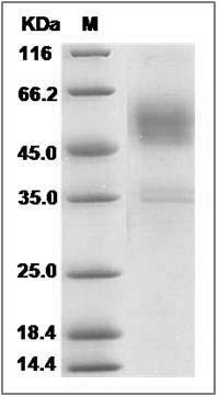 Cynomolgus TRAIL R4 / CD264 / TNFRSF10D Protein (His Tag) SDS-PAGE