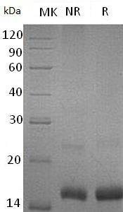 Mouse Ccl3/Mip1a/Scya3 (His tag) recombinant protein