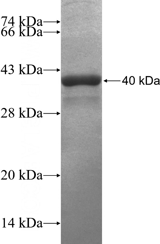 Recombinant Human AZIN1 SDS-PAGE
