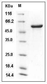 Mouse P4HB / ERBA2L Protein (His Tag) SDS-PAGE
