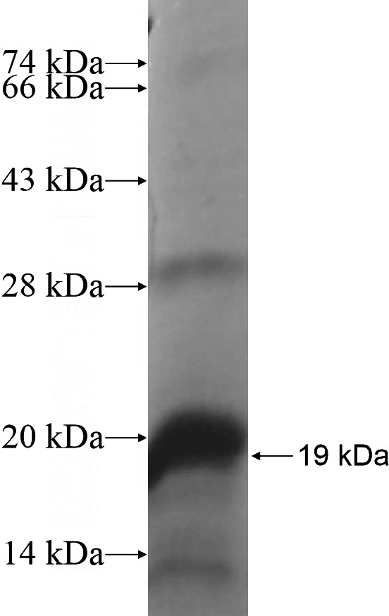 Recombinant Human TBX20 SDS-PAGE