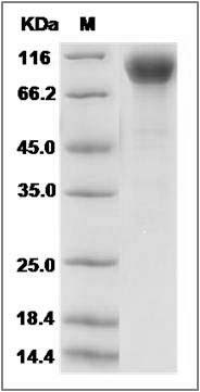 Rat PDGFRB / PDGFR-1 Protein (His Tag) SDS-PAGE