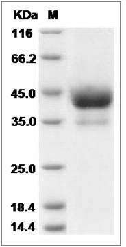 Rat ACVR1B / ALK-4 Protein (Fc Tag) SDS-PAGE