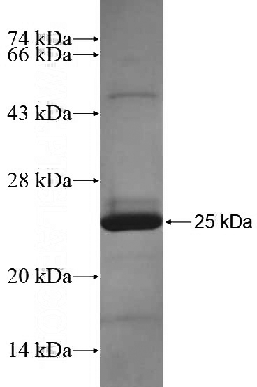 Recombinant Human C3AR1 SDS-PAGE