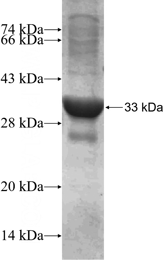 Recombinant Human REDD1 SDS-PAGE