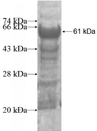 Recombinant Human ATP2C1 SDS-PAGE