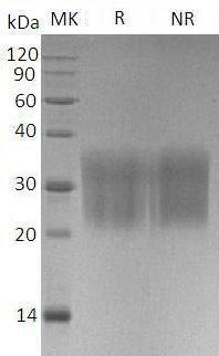 Mouse Ccl2/Je/Mcp1/Scya2 (His tag) recombinant protein