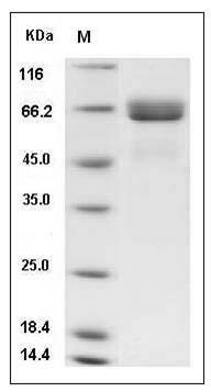Human Alkaline Phosphatase / ALPI Protein (His Tag) SDS-PAGE