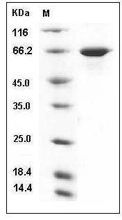 Human USH1C / Harmonin Protein (His Tag) SDS-PAGE