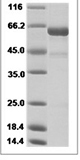 H5N6 HA Protein 15326