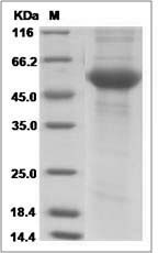 Influenza A H5N8 Protein (A/breeder duck/Korea/Gochang1/2014) Hemagglutinin / HA1 Protein (His Tag)