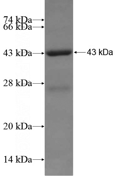 Recombinant Human TRHDE SDS-PAGE