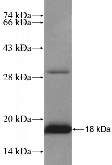 Recombinant Human ATP8A1 SDS-PAGE