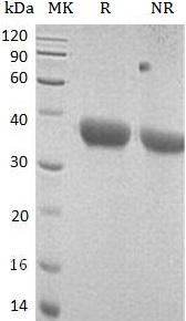Mouse Cxcl16/Srpsox (His tag) recombinant protein