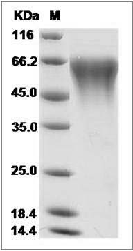 Human CLM-9 / TREM4 / CD300LG Protein (His Tag) SDS-PAGE