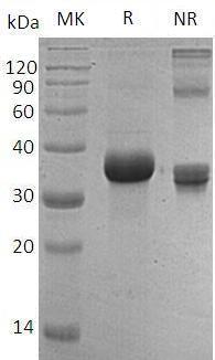 Human FSTL1/FRP (His tag) recombinant protein