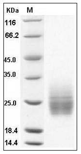Human KIM-1 / TIM1 / HAVCR1 Protein (aa 1-135, His Tag) SDS-PAGE