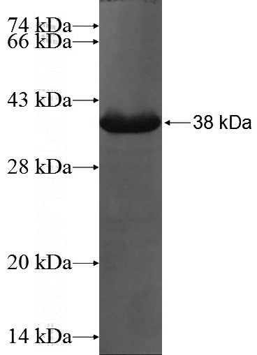 Recombinant Human PIGG SDS-PAGE