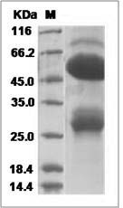 Human GGT5 / GGTLA1 Protein (His Tag) SDS-PAGE