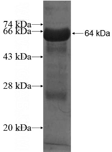 Recombinant Human NUDT9 SDS-PAGE