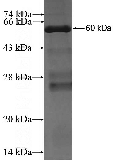 Recombinant Human DTX3L SDS-PAGE