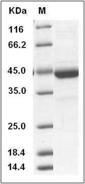 Mouse Cystatin 7 / CST7 Protein (Fc Tag) SDS-PAGE