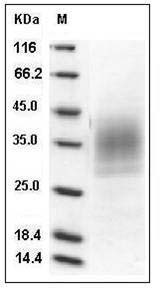 Mouse TREM2 Protein (His Tag) SDS-PAGE
