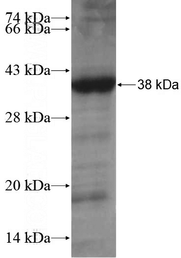 Recombinant Human CCDC45 SDS-PAGE