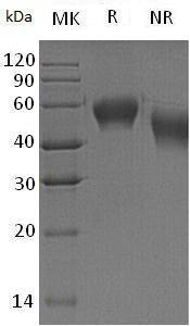 Human CD46/MCP/MIC10 (His tag) recombinant protein