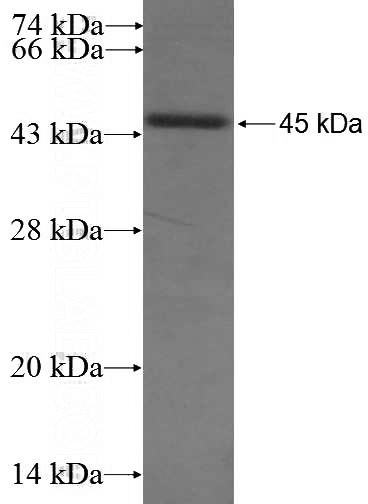 Recombinant Human OSBPL2 SDS-PAGE