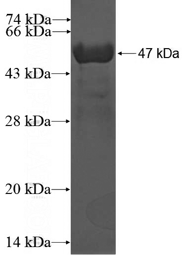 Recombinant Human ZNF189 SDS-PAGE