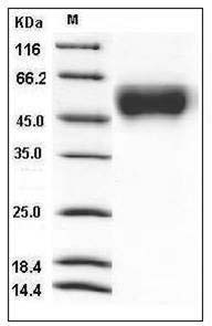 Mouse IL2RG / CD132 Protein (His Tag) SDS-PAGE