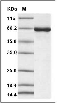 Mouse CSNK2A1 / CK2A1 Protein (His & GST Tag) SDS-PAGE
