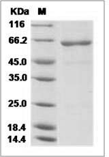 Influenza A H5N1 (A/hubei/2011-CDC) Hemagglutinin / HA Protein (His Tag)
