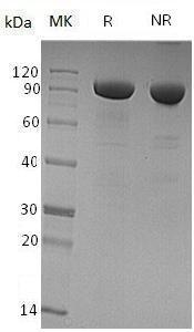 Human TIE1/TIE (His tag) recombinant protein
