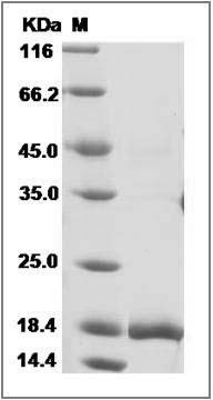 Human G-CSF / CSF3 Protein (isoform b) SDS-PAGE