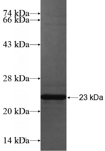 Human EGF Recombinant protein (6*His tag)