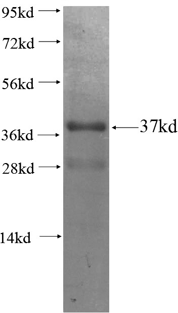 Recombinant Human TBX1 SDS-PAGE