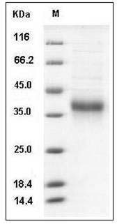 Mouse Ephrin-A3 / EFNA3 Protein (His Tag) SDS-PAGE