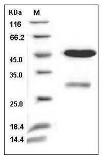 Human Uracil-DNA glycosylase / UNG Protein (GST Tag) SDS-PAGE