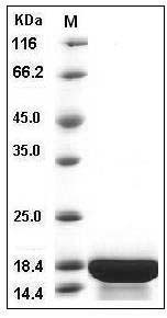 Human Interleukin-21 / IL-21 Protein SDS-PAGE